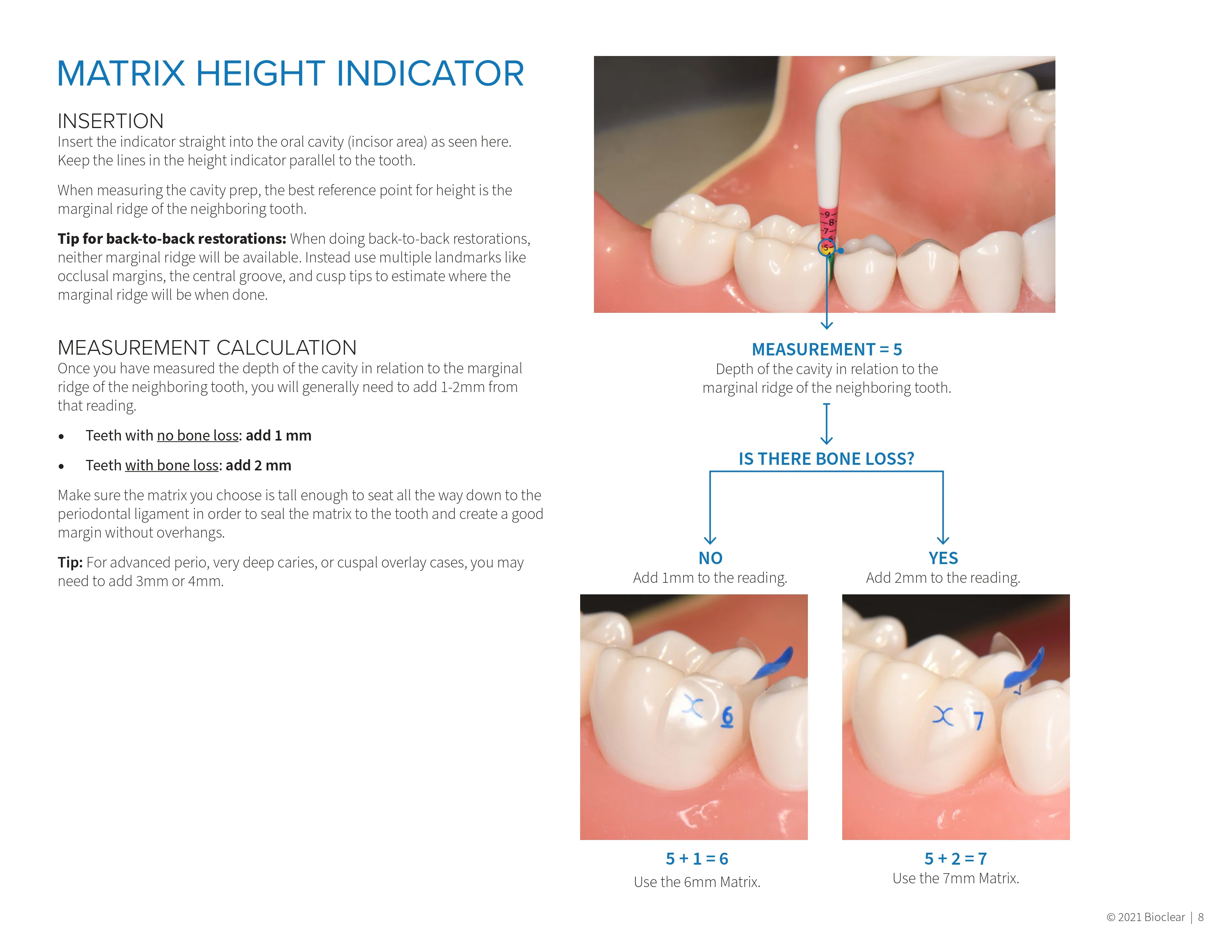 이볼브 매트릭스 하이트 인디케이터 (EMHI) Evolve Matrix Height Indicator (EMHI)